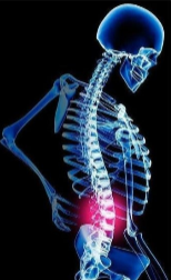 Suporte de Correção para Costas c/ Estacas de Neoprene